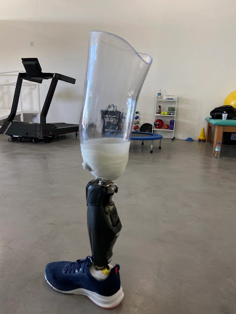 Prosthetic used as a reference during Father Miguel's rehabilitation process